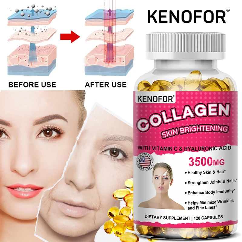 KENOFOR Collagen Softgel Supports Healthy Skin, Hair, Nails and Joint Supplementation, Anti-aging and Immunity Enhancement
KENOFOR Collagen Softgel Supports Healthy Skin, Hair, Nails and Joint Supplementation, Anti-aging and Immunity Enhancement