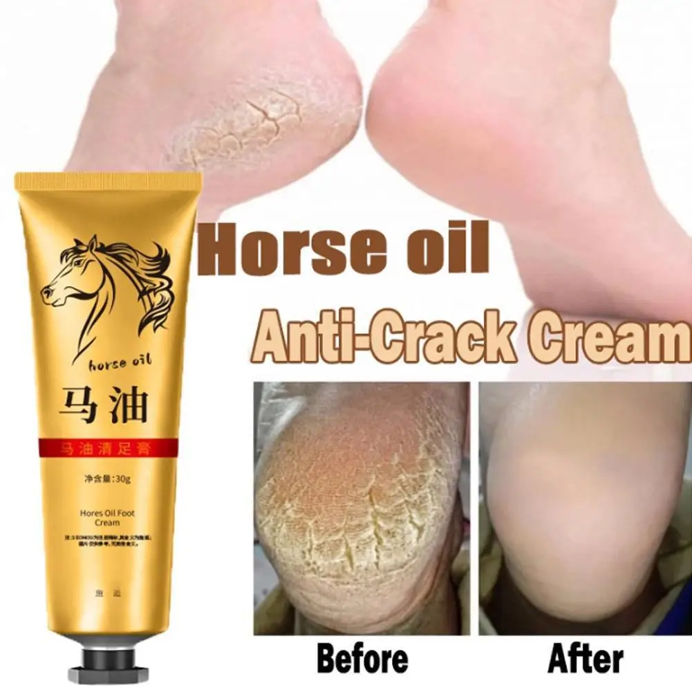 30g Horse Oil Moisturizing Foot Cream Repair Dry Crack Nourish Hand Foot Skin Prevent Freezing And Repair Frostbite Care Product
30g Horse Oil Moisturizing Foot Cream Repair Dry Crack Nourish Hand Foot Skin Prevent Freezing And Repair Frostbite Care Product
