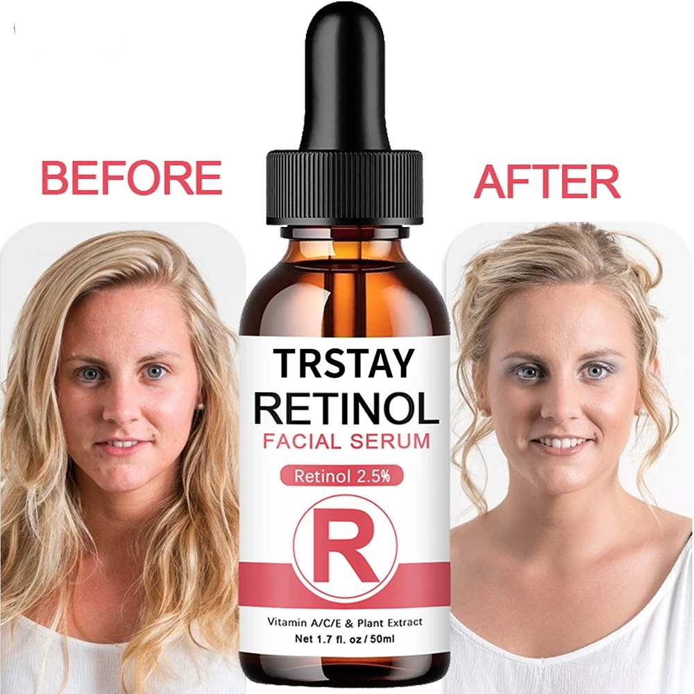 SDP Retinol Face Serum 2.5% With Hyaluronic Acid Anti Wrinkle Whitening Moisturizing Brightening Retinol Essence Skin Care
SDP Retinol Face Serum 2.5% With Hyaluronic Acid Anti Wrinkle Whitening Moisturizing Brightening Retinol Essence Skin Care