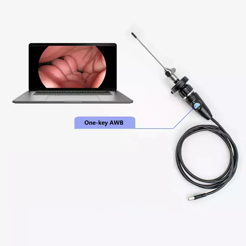 Full HD CMOS Medical Portable USB Endoscop Camer for ENT Nasal Otoscope Ear Laparoscopic Gynecology
Full HD CMOS Medical Portable USB Endoscop Camer for ENT Nasal Otoscope Ear Laparoscopic Gynecology
