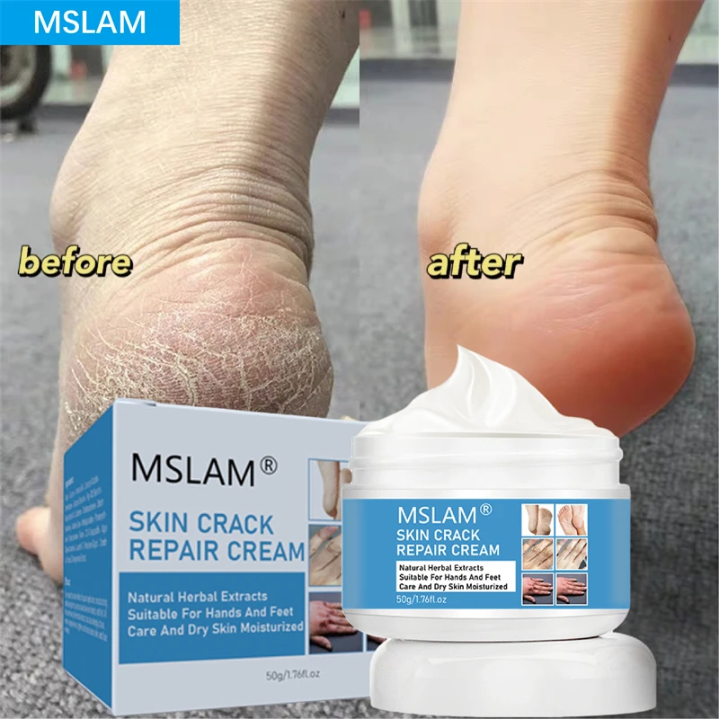 50g Foot Fungus Removal Cream Relieve Foot Itching Remove Beriberi Dead Skin Foot Sweat Moisturize Repair Foot Cracked Ointment 
50g Foot Fungus Removal Cream Relieve Foot Itching Remove Beriberi Dead Skin Foot Sweat Moisturize Repair Foot Cracked Ointment
