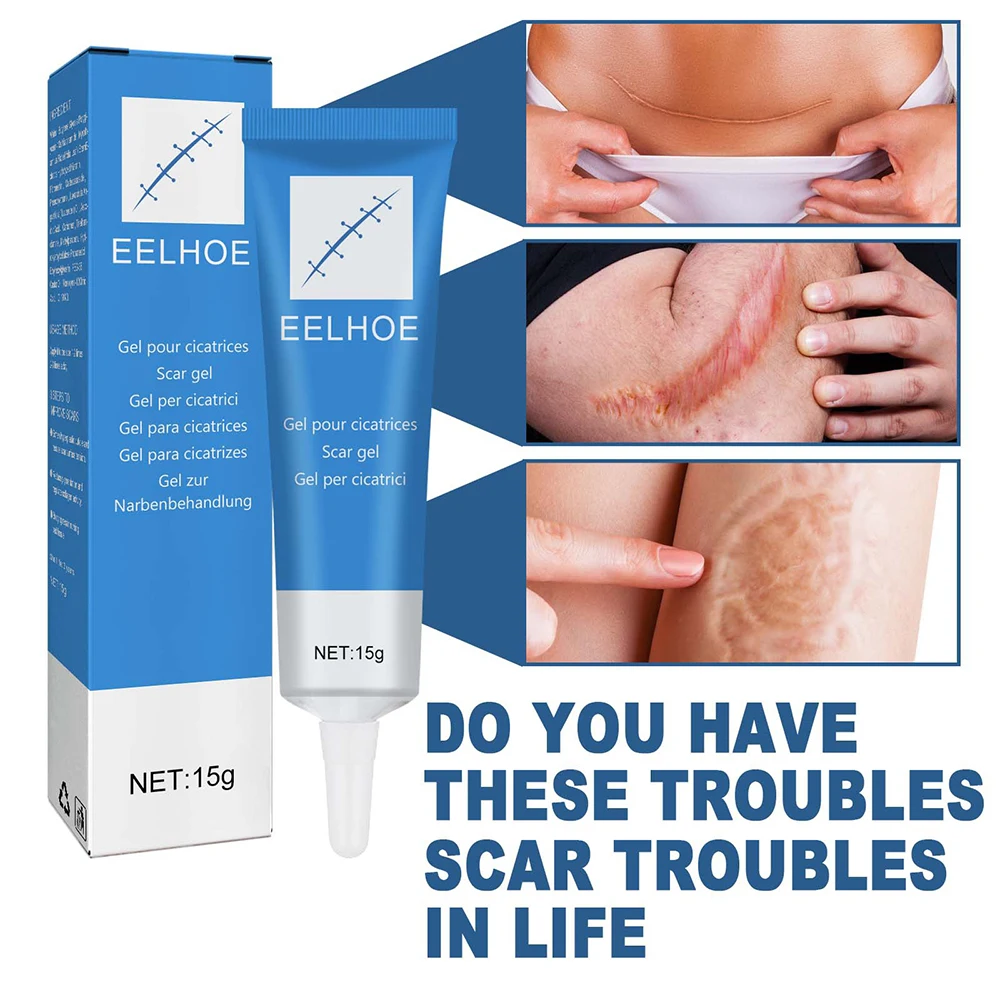 Scar Removal Gel Stretch Marks Burn Surgical Scar Repair Cream Skin Smoothing Whitening Remove Acne Spots Treatment
Scar Removal Gel Stretch Marks Burn Surgical Scar Repair Cream Skin Smoothing Whitening Remove Acne Spots Treatment