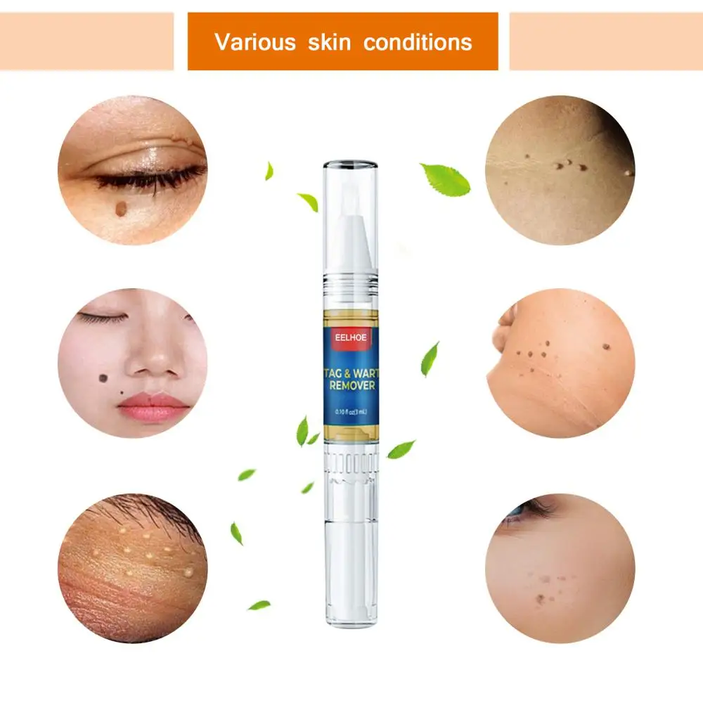 Gram Wart Pen Portable Liquid Skin Tag Cure Removal Body Skin Mole Wart Remover Spot Marks Wart Remover For Skin Care
Gram Wart Pen Portable Liquid Skin Tag Cure Removal Body Skin Mole Wart Remover Spot Marks Wart Remover For Skin Care