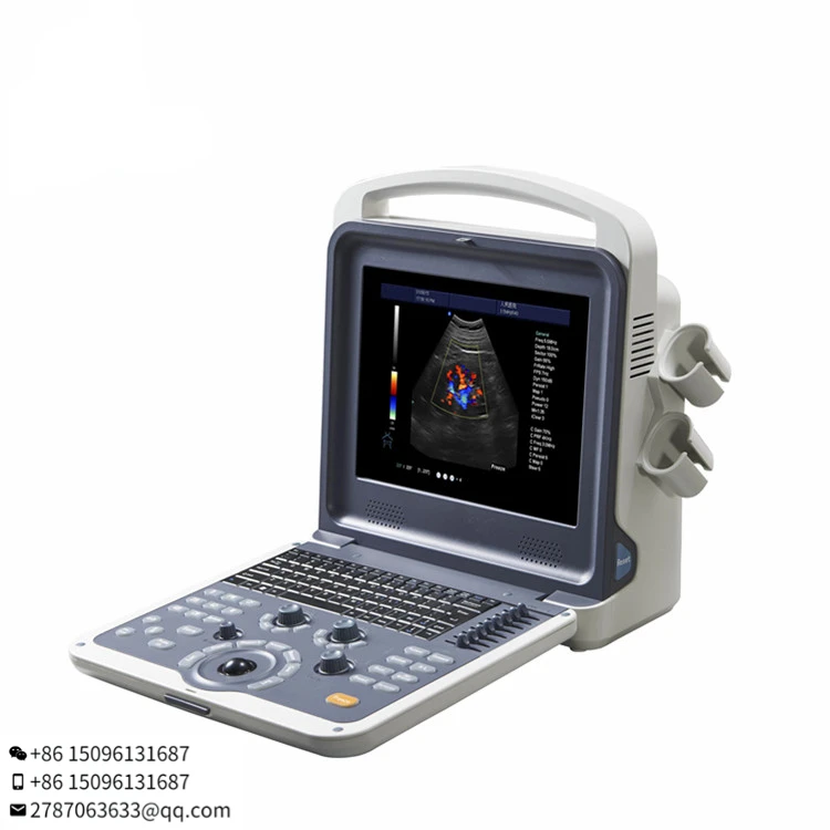 BT-UD11 hospital veterinary linear probe ultrasound scanner 4D Portable color doppler machine ultrasound machine
BT-UD11 hospital veterinary linear probe ultrasound scanner 4D Portable color doppler machine ultrasound machine
