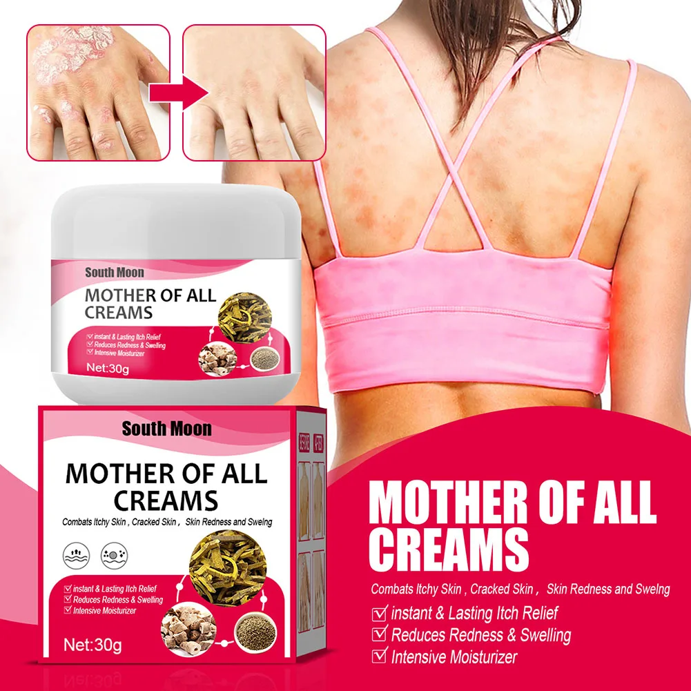 30g Skin Psoriasis Cream Natural Herbal Ointment Relieve Itching Swelling Anti-Itch For Dermatitis Eczematoid Eczema Skin Care
30g Skin Psoriasis Cream Natural Herbal Ointment Relieve Itching Swelling Anti-Itch For Dermatitis Eczematoid Eczema Skin Care