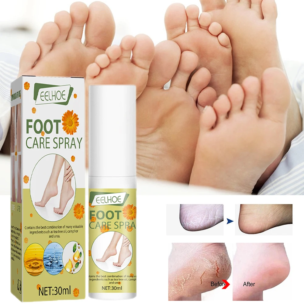 30ml Foot Care Spray Moisturizing Exfoliating Anti-Drying Lotion for Feet Foot Care For Dry Cracked Feet THJ99
30ml Foot Care Spray Moisturizing Exfoliating Anti-Drying Lotion for Feet Foot Care For Dry Cracked Feet THJ99