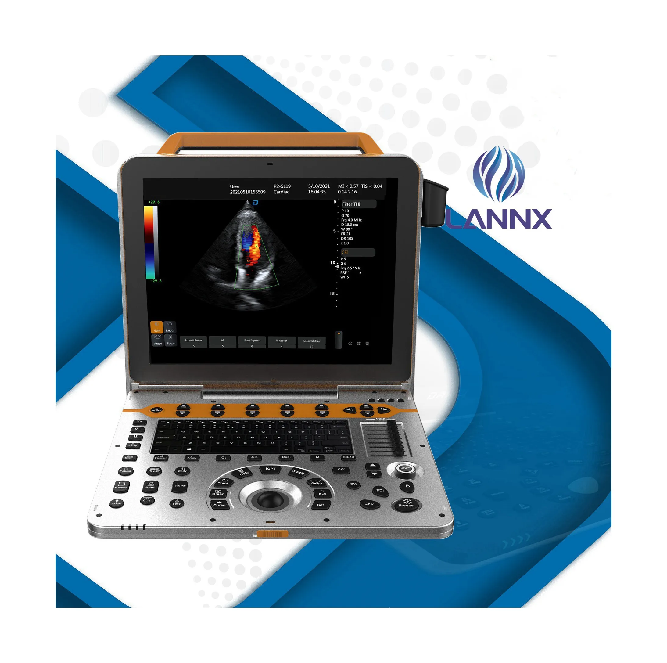 LANNX manufacturer Ultrasound Machine 15 Inches Portable Medical ultrasonic Instruments advanced usg Color Ultrasound
LANNX manufacturer Ultrasound Machine 15 Inches Portable Medical ultrasonic Instruments advanced usg Color Ultrasound