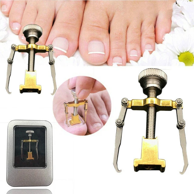 Ingrown Toenails Pedicure Foot Nail Care Tools File Massage for Feet Orthotic Acronyx Ingrowing Nail Onyxis Foot Massage Relax
Ingrown Toenails Pedicure Foot Nail Care Tools File Massage for Feet Orthotic Acronyx Ingrowing Nail Onyxis Foot Massage Relax