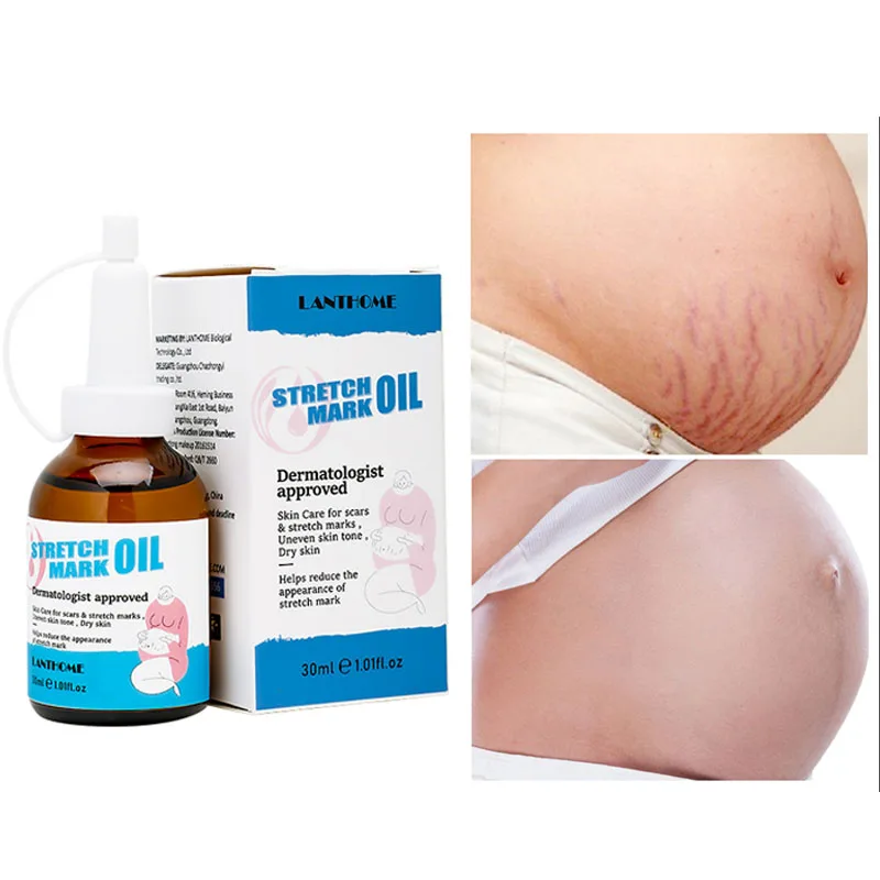 Remove Pregnancy Scars oil Stretch Mark Treatment Maternity Repair Gravidarum Treatment Firming Stretch Scar Remover jojoba oil
Remove Pregnancy Scars oil Stretch Mark Treatment Maternity Repair Gravidarum Treatment Firming Stretch Scar Remover jojoba oil