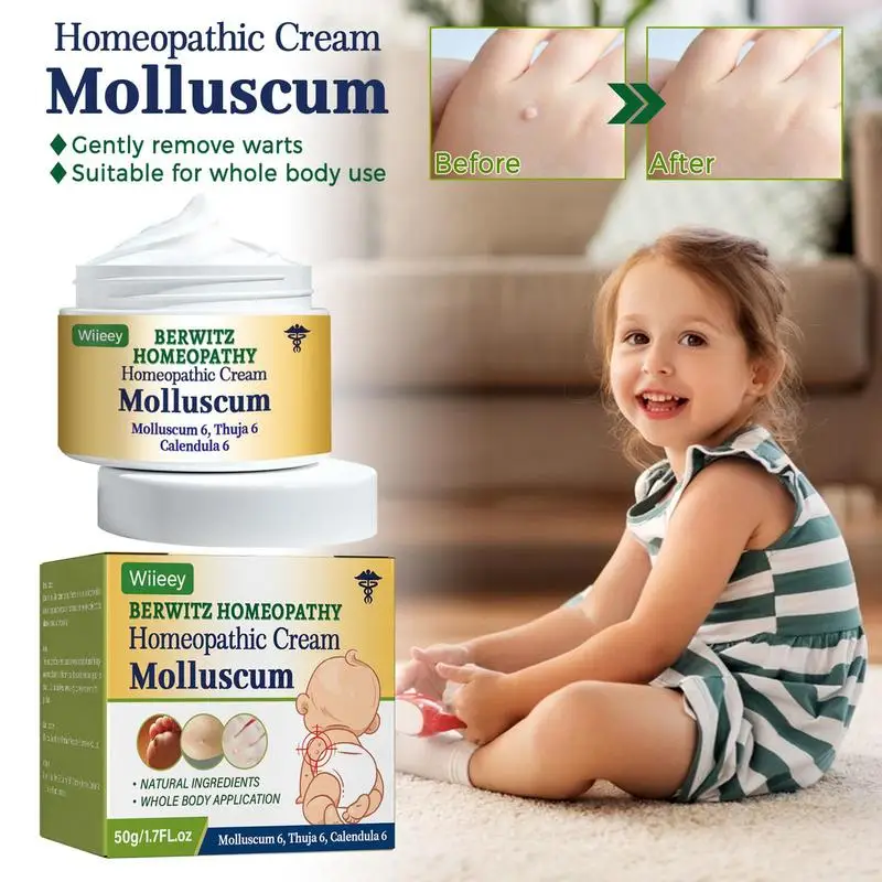 Natural Ingredients Mole Removal Lotion Children's Wart Control Ointment 50g Resinol Medicated Ointment For Protection Of Skin
Natural Ingredients Mole Removal Lotion Children's Wart Control Ointment 50g Resinol Medicated Ointment For Protection Of Skin