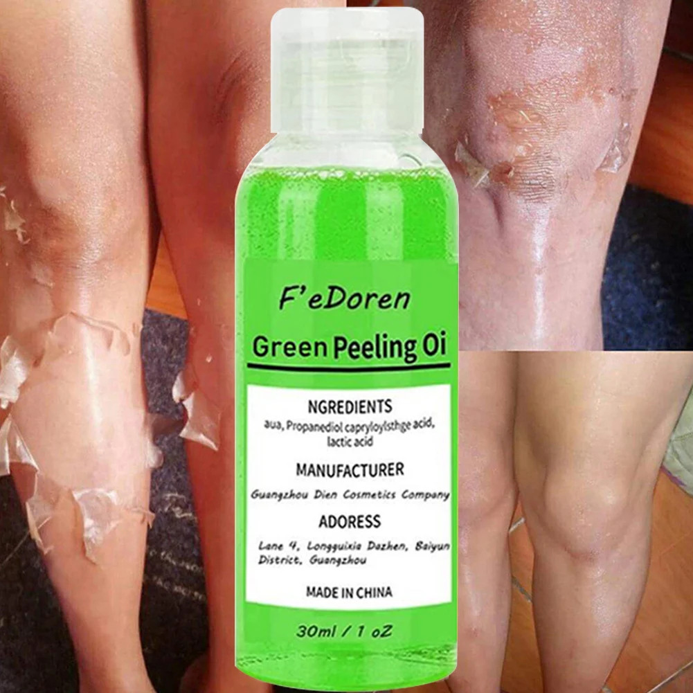 30/50ML Yellow Body Peeling Oil Dark Spot Remover Skin Bleaching Brightening Oil Deep Peeling Exfoliating Serum For Face Body
30/50ML Yellow Body Peeling Oil Dark Spot Remover Skin Bleaching Brightening Oil Deep Peeling Exfoliating Serum For Face Body