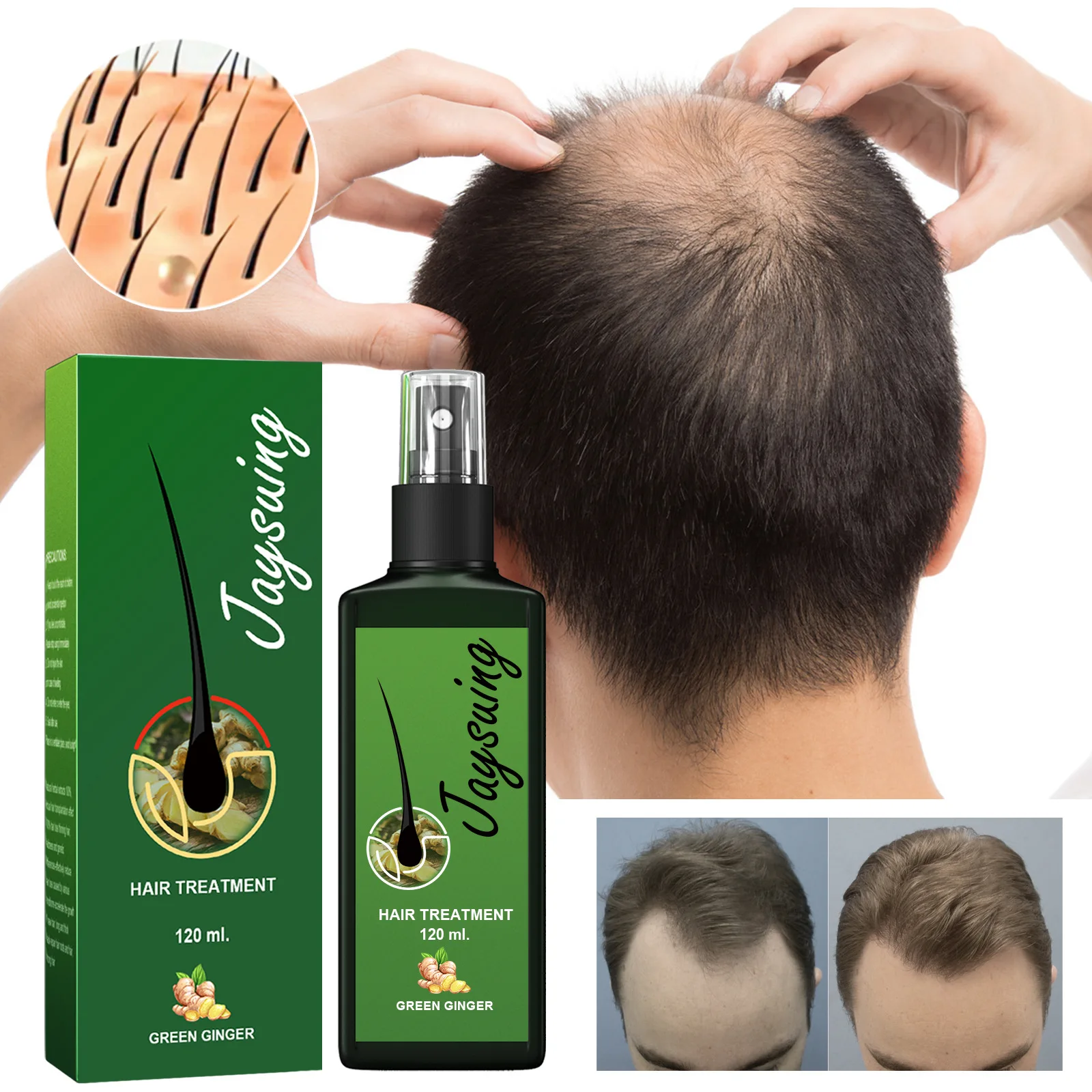 Sdotter 30/120ml Jaysuing Hair Growth Oil Strong hair Scalp Massage Liquid Fast Growing Germinal Anti-loss Treatment Serum Hair
Sdotter 30/120ml Jaysuing Hair Growth Oil Strong hair Scalp Massage Liquid Fast Growing Germinal Anti-loss Treatment Serum Hair