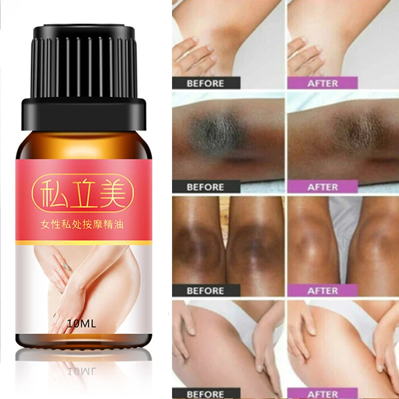 Intimate Area Pink Essence Body Whitening Cream Underarm Knee Butt Dullness Brighten Improve Lip Moisturizer Facial Beauty Care
Intimate Area Pink Essence Body Whitening Cream Underarm Knee Butt Dullness Brighten Improve Lip Moisturizer Facial Beauty Care