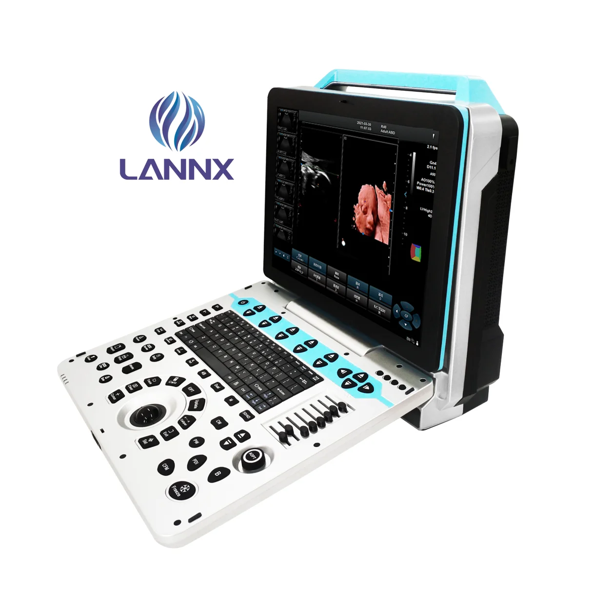 Hot sale 4D 5D Colour Doppler Ultrasound Portable Scanner Echo Hospital medical ultrasound instruments OB/GYN Ultraschall Usg
Hot sale 4D 5D Colour Doppler Ultrasound Portable Scanner Echo Hospital medical ultrasound instruments OB/GYN Ultraschall Usg