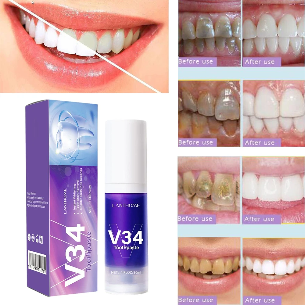 Teeth Whitening Mousse Foam Toothpaste Removes Stains Teeth Deep Cleaning Care Spray Ultra-fine Foam Fresh Breath Dental Care
Teeth Whitening Mousse Foam Toothpaste Removes Stains Teeth Deep Cleaning Care Spray Ultra-fine Foam Fresh Breath Dental Care