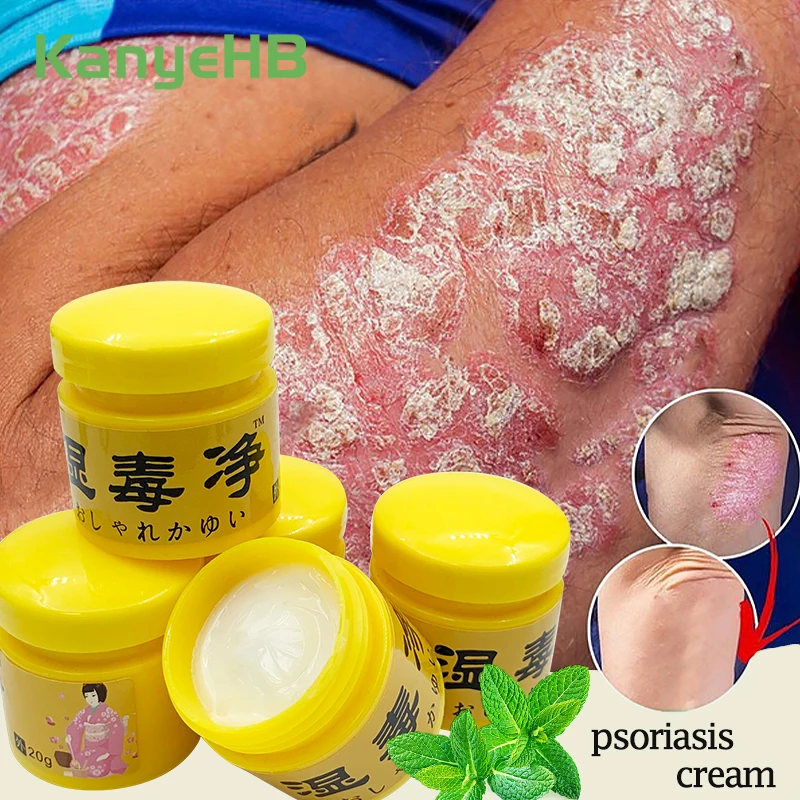 1/3/5Pcs Psoriasis Ointment Anti-itch Treat Desquamation Eczema Dermatitis Tinea Pedis Inhibit Fungi Medical Skin Care Ointment
1/3/5Pcs Psoriasis Ointment Anti-itch Treat Desquamation Eczema Dermatitis Tinea Pedis Inhibit Fungi Medical Skin Care Ointment