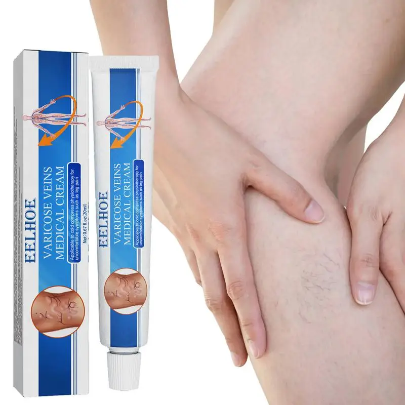 25g Cream Eliminate And Spider Veins Varicose Remover For Legs Foot Hands Toes
25g Cream Eliminate And Spider Veins Varicose Remover For Legs Foot Hands Toes