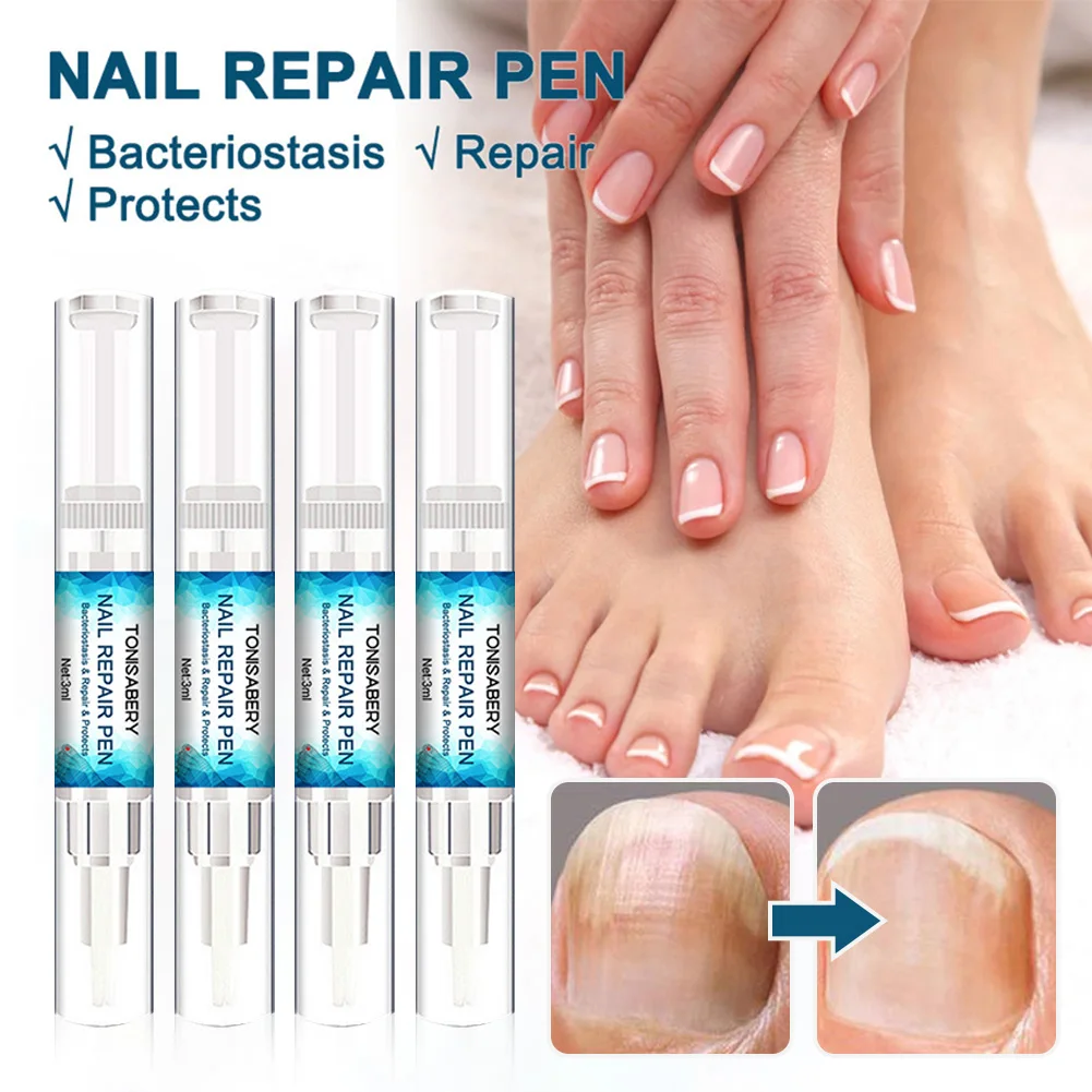 4pcs Fungal Nail Repair Pen Natural Formula Nail Repair Liquid Pen For Onychomycosis Paronychia Discoloration Fungus Nail Care
4pcs Fungal Nail Repair Pen Natural Formula Nail Repair Liquid Pen For Onychomycosis Paronychia Discoloration Fungus Nail Care