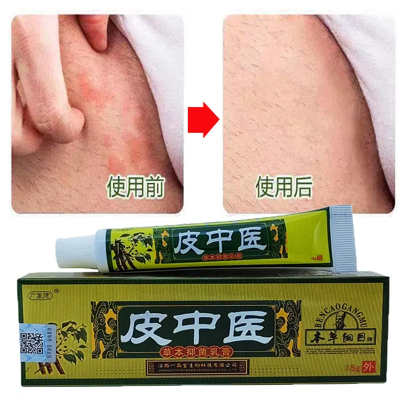 Useful Psoriasis Ointment Dermatitis Eczematoid Eczema Ointment Dermatitis Anti Fungal Infection Atopic DermatiTis Cream
Useful Psoriasis Ointment Dermatitis Eczematoid Eczema Ointment Dermatitis Anti Fungal Infection Atopic DermatiTis Cream