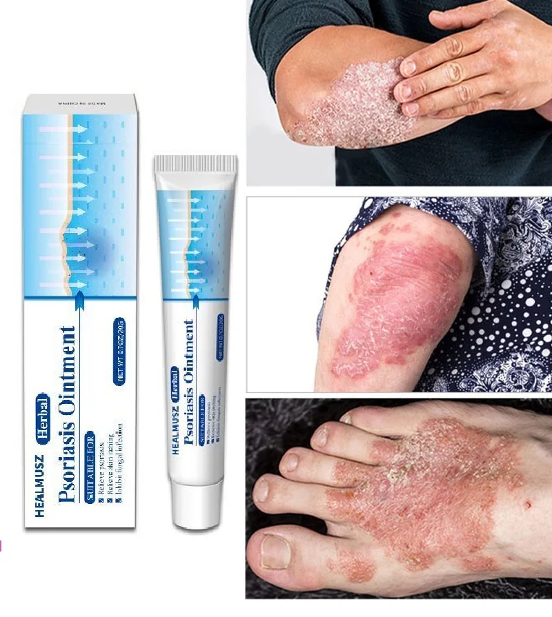3pcs Antibacterial Psoriasis Cream Herbal Effective Anti-itch Relief Dermatitis Eczema Treatment Urticaria Desquamation Skin Car
3pcs Antibacterial Psoriasis Cream Herbal Effective Anti-itch Relief Dermatitis Eczema Treatment Urticaria Desquamation Skin Car