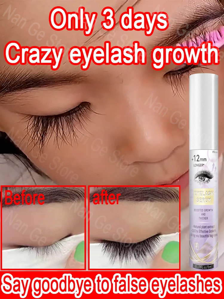 Soro De Crescimento Rápido De Cílios, Sobrancelha Melhorando, Levantamento De Lash, Alongamento Da Pestana, Natural, 3 Dias
Soro De Crescimento Rápido De Cílios, Sobrancelha Melhorando, Levantamento De Lash, Alongamento Da Pestana, Natural, 3 Dias