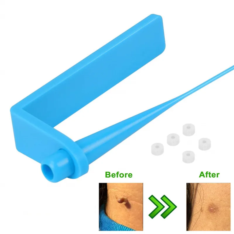1Set Skin Tag Skin Mole Wart Remove Cleaning Tool Micro Skin Tag Removal Kit With Cleansing Swabs Adult Mole Wart Face Care Kit
1Set Skin Tag Skin Mole Wart Remove Cleaning Tool Micro Skin Tag Removal Kit With Cleansing Swabs Adult Mole Wart Face Care Kit