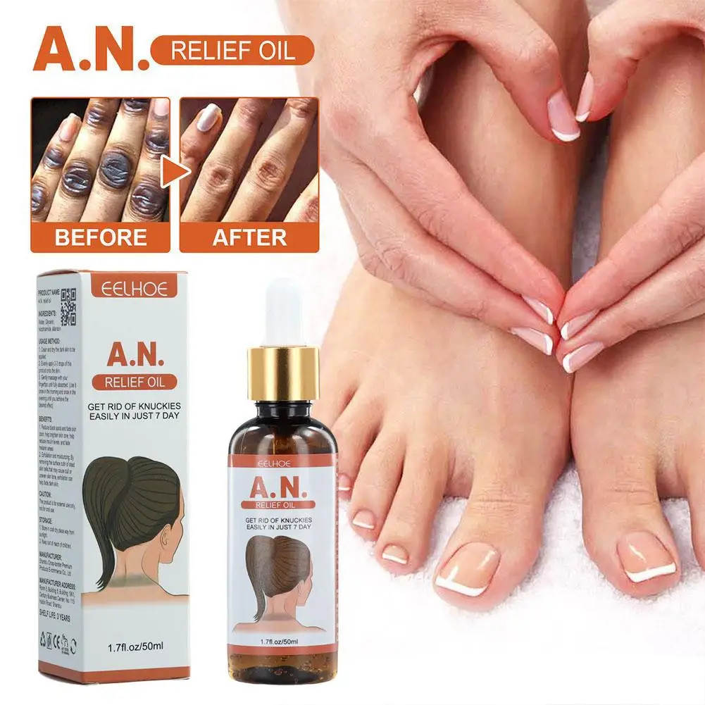 Acanthosis Nigricans Therapy Oil Dark Spot Corrector Oil Dark Knuckle Whitening Serum for Removing Dark Knuckle Elbow N7L4
Acanthosis Nigricans Therapy Oil Dark Spot Corrector Oil Dark Knuckle Whitening Serum for Removing Dark Knuckle Elbow N7L4