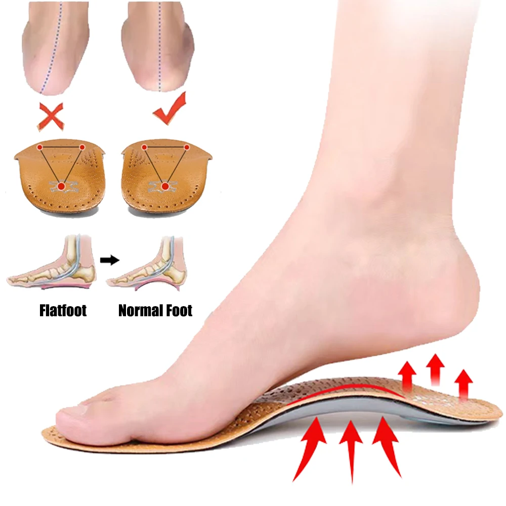 

Leather Orthotic Insole for Sport Arch Support Flat Foot Orthopedic Insoles for Shoes Women Men X/O Leg Correction Shoe Inserts