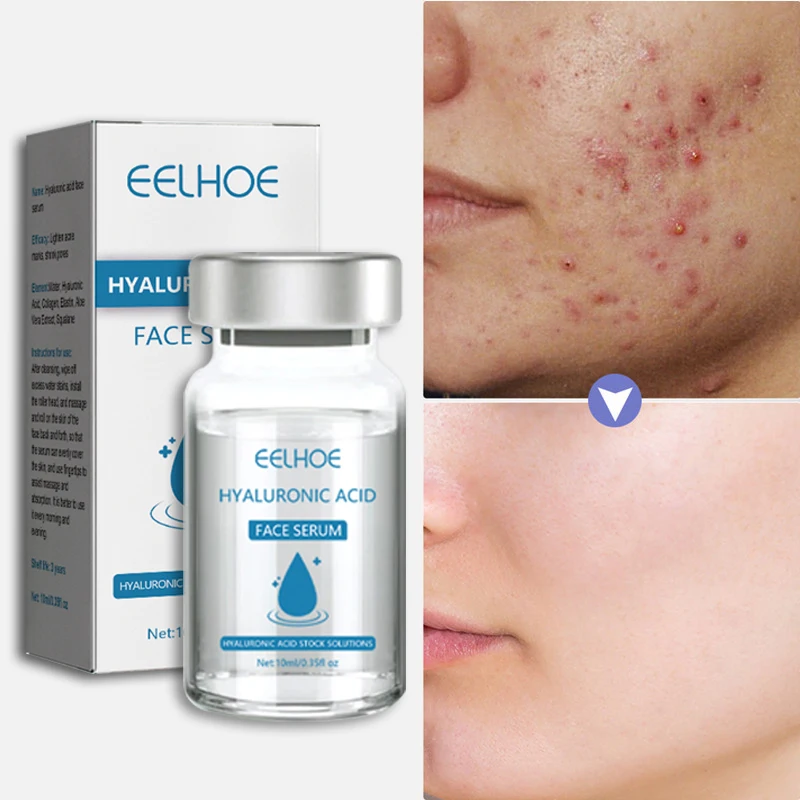 Essence That Lightens Acne and Acne Marks Brightens Skin Tone Moisturizing Shrinks Pores Facial Care Hyaluronic Acid Serum 10ml
Essence That Lightens Acne and Acne Marks Brightens Skin Tone Moisturizing Shrinks Pores Facial Care Hyaluronic Acid Serum 10ml
