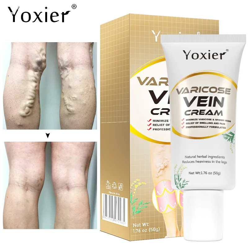 Varicose Vein Repair Cream Soothing Pain Relief Phlebitis Spider Vein Improves Blood Circulation Herbal Body Skin Care Products
Varicose Vein Repair Cream Soothing Pain Relief Phlebitis Spider Vein Improves Blood Circulation Herbal Body Skin Care Products