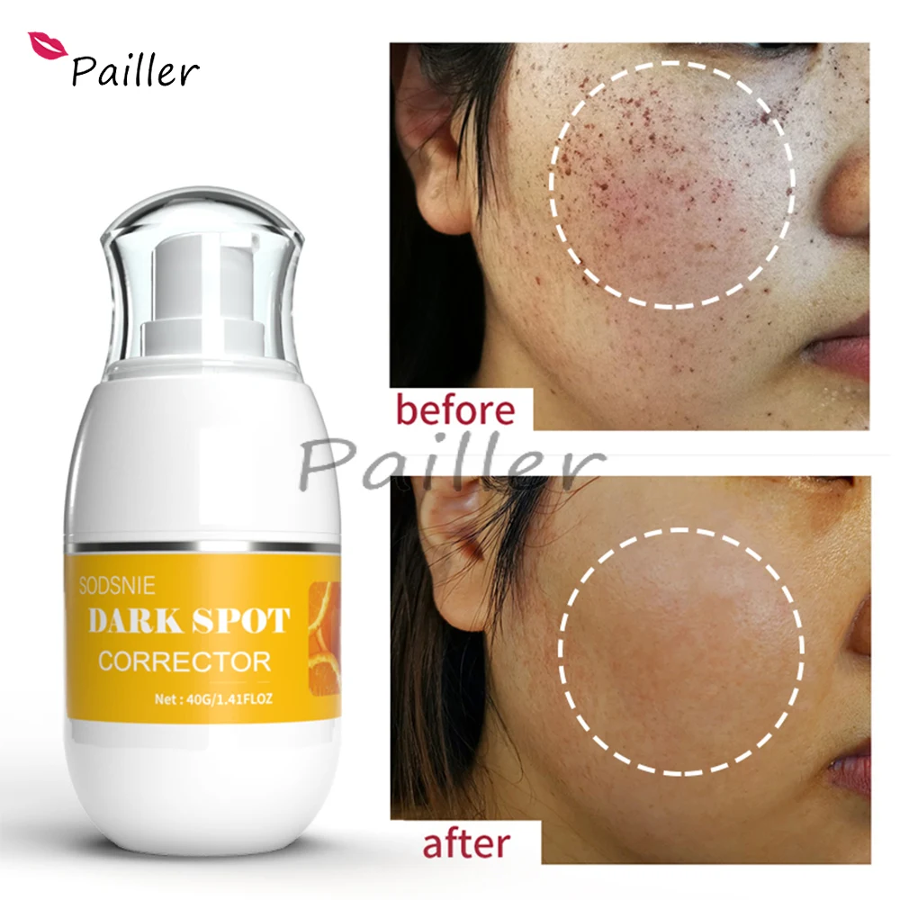 Корректор для темных точек 40 г, увлажняющий эффективно удаляет темные пятна, хлоазма, возрастные пятна от солнца, кожу 
Корректор для темных точек 40 г, увлажняющий эффективно удаляет темные пятна, хлоазма, возрастные пятна от солнца, кожу