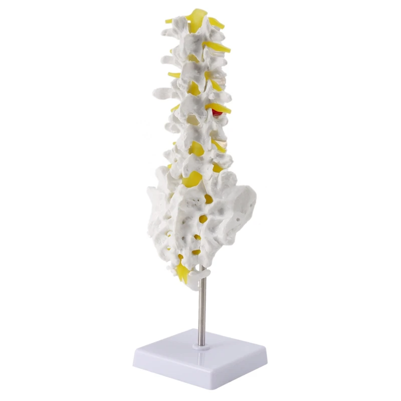 Human 5 Lumbar Vertebrae with Sacrum and Coccyx Teaching Lumbar Intervertebral Bone Model Anatomical Model
Human 5 Lumbar Vertebrae with Sacrum and Coccyx Teaching Lumbar Intervertebral Bone Model Anatomical Model