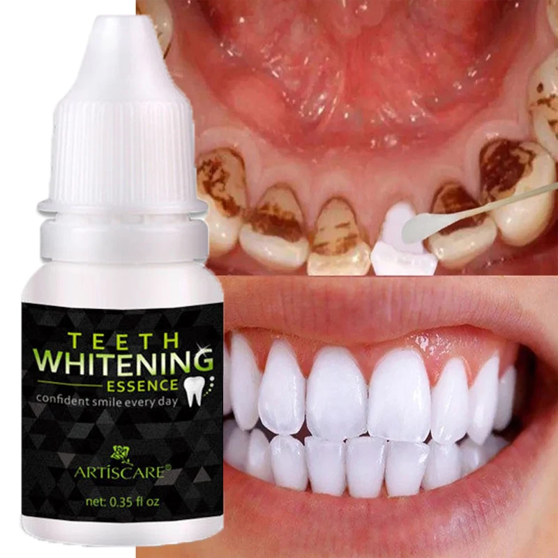 Teeth Whitening Essence Serum Clean Oral Hygiene Tooth Dental Fresh Breath Care Products Remove Pigment Coffee Tea Stains Tools
Teeth Whitening Essence Serum Clean Oral Hygiene Tooth Dental Fresh Breath Care Products Remove Pigment Coffee Tea Stains Tools