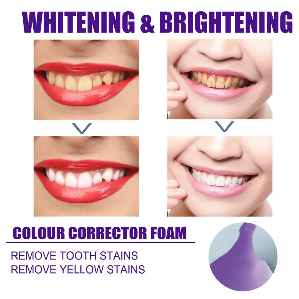 Профессиональный Крем для зубов, бережно удаляет телефон, эффективная отбеливающая зубная паста, принадлежности для чистки рта
Профессиональный Крем для зубов, бережно удаляет телефон, эффективная отбеливающая зубная паста, принадлежности для чистки рта