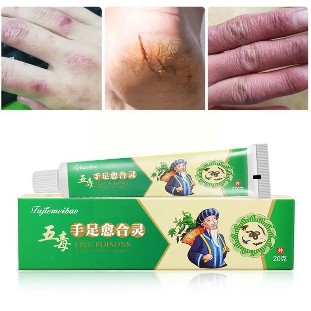 20 г сухих рук и ног на сухих треснутых каблуках, сухая треснувшая мороза, прогулочная нога унисекс и мазь по уходу, защита от трещин K4O7
20 г сухих рук и ног на сухих треснутых каблуках, сухая треснувшая мороза, прогулочная нога унисекс и мазь по уходу, защита от трещин K4O7