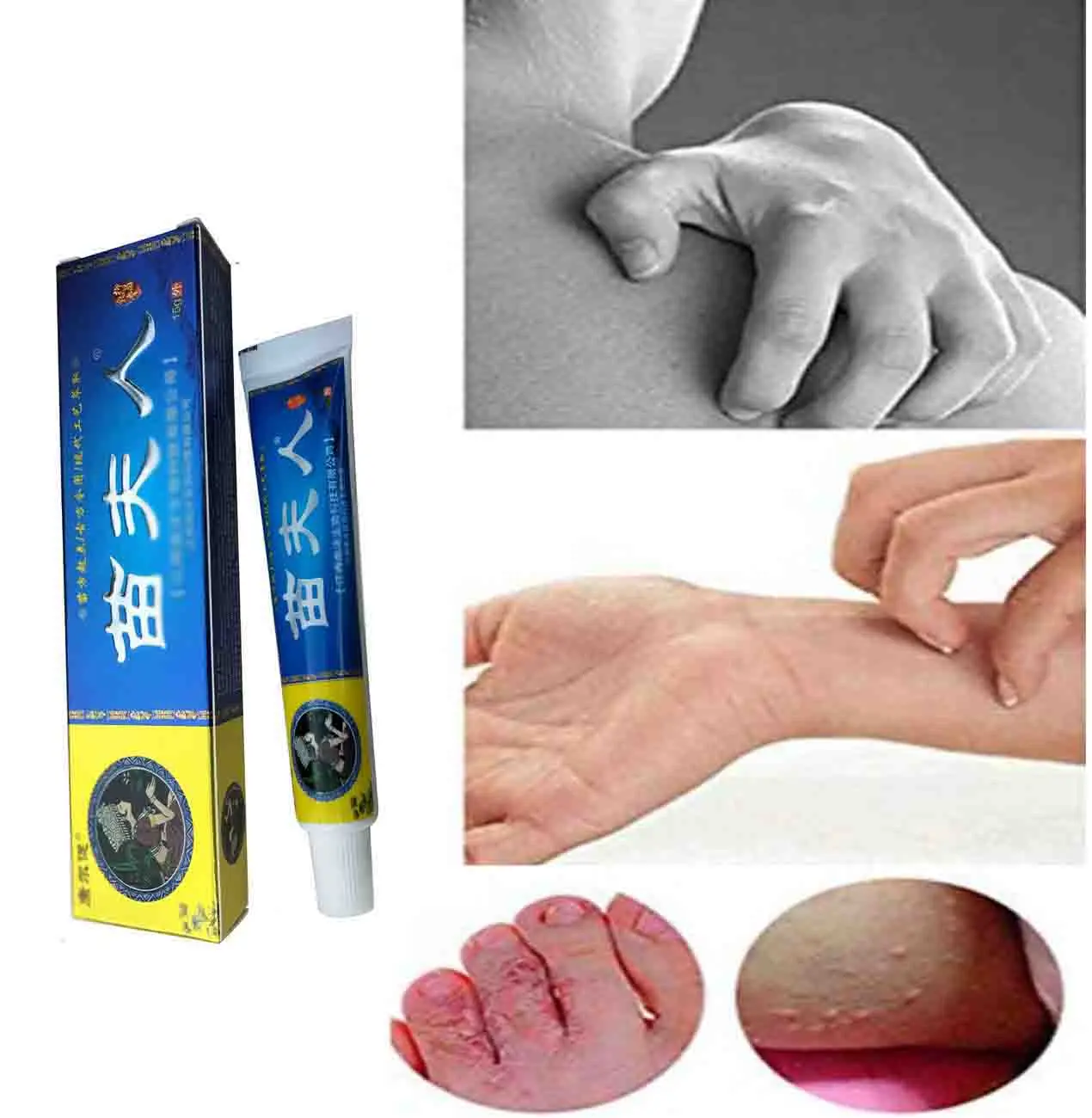 

Treatment Psoriasis Ointment Natural Chinese Herbal Eczema Creams Dermatitis Pruritus Anti-Itch MFR