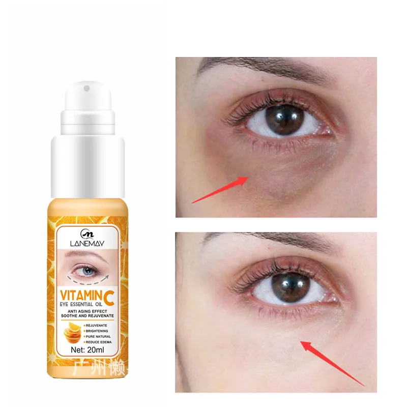 Vitamin C Anti Dark Circle Eye Cream Eye Bags Removal Fade Fine Lines Anti-wrinkle Lifting Cream Whitening Smooth Skin Eyes Care
Vitamin C Anti Dark Circle Eye Cream Eye Bags Removal Fade Fine Lines Anti-wrinkle Lifting Cream Whitening Smooth Skin Eyes Care
