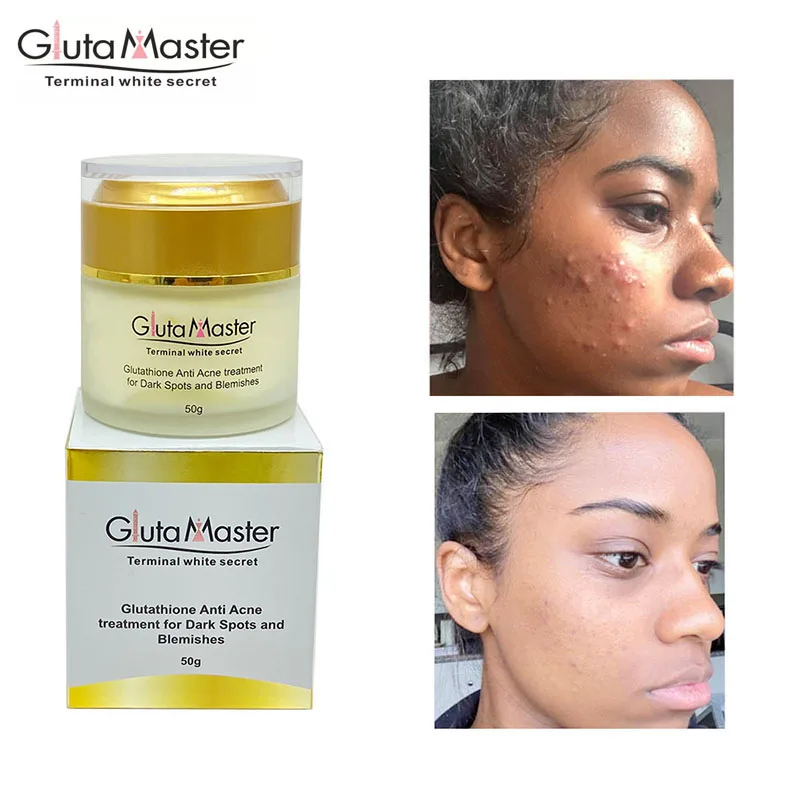 Gluta Master Face Cream, Facial Whitening Acne Brightening Anti-Dark Spot Natural Non-Irritating Facial Cream, Korean skin care
Gluta Master Face Cream, Facial Whitening Acne Brightening Anti-Dark Spot Natural Non-Irritating Facial Cream, Korean skin care
