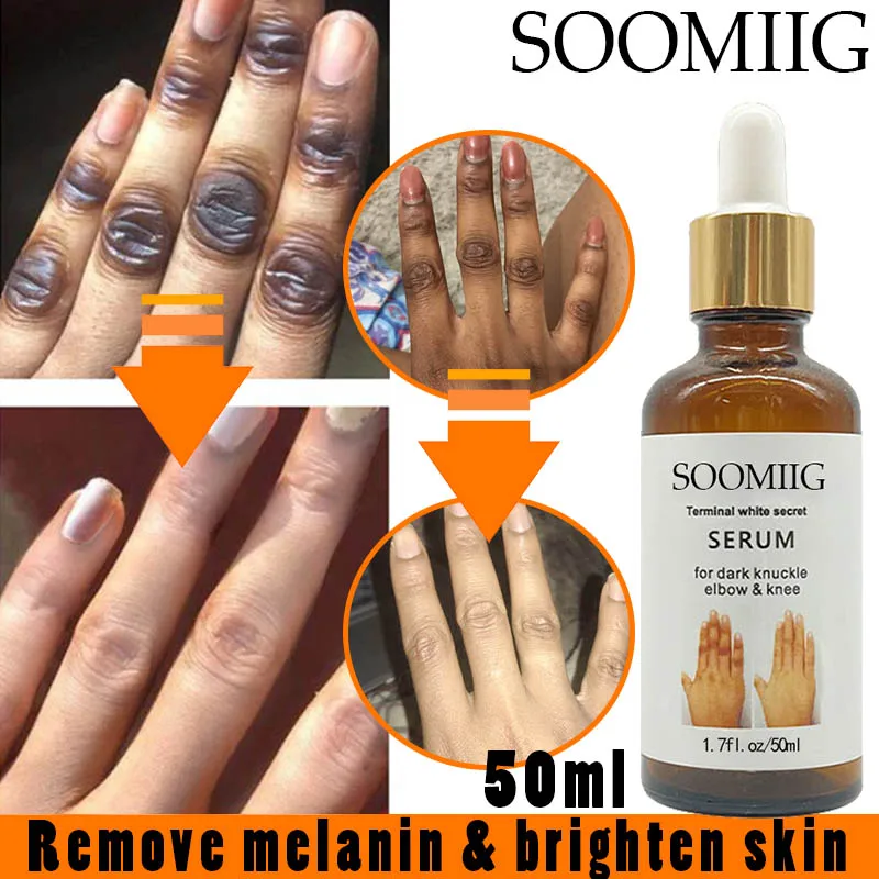 Skin melatonin essence, smooth and moisturize essence skin, bleach armpits, knees and buttocks, brighten skin care
Skin melatonin essence, smooth and moisturize essence skin, bleach armpits, knees and buttocks, brighten skin care