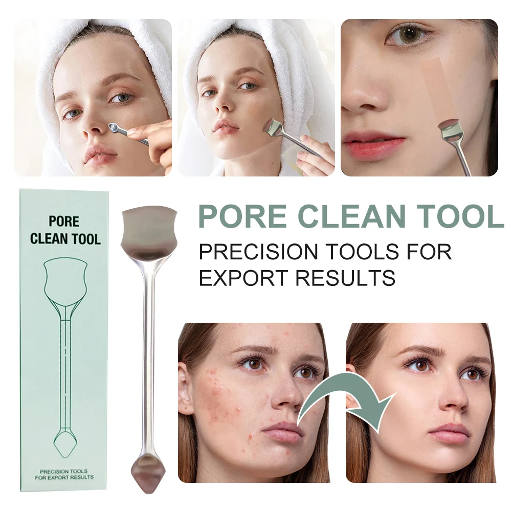 2022 New Stainless Steel Acne Removal Tool Double-Headed Pimple Blackhead Remover Pore Cleaner Facial Makeup Remover Skin Care
2022 New Stainless Steel Acne Removal Tool Double-Headed Pimple Blackhead Remover Pore Cleaner Facial Makeup Remover Skin Care