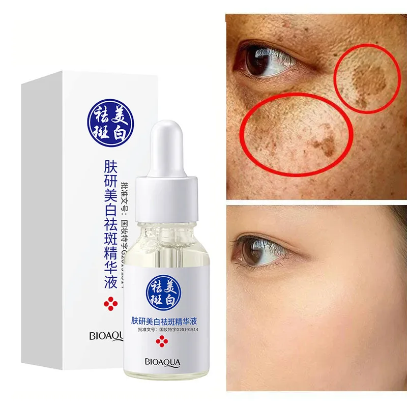Whitening Freckle Serum Remove Dark Spots Niacinamide Fade Pigmentation Melasma Sunspot Brighten Moisturizing Skin Care Products
Whitening Freckle Serum Remove Dark Spots Niacinamide Fade Pigmentation Melasma Sunspot Brighten Moisturizing Skin Care Products