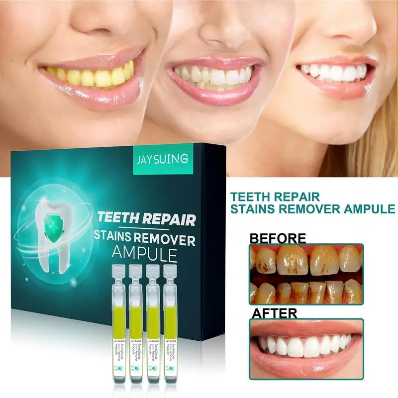 7Pcs/Box Essence Teeth Bleaching | Ampoule Toothpaste for Teeth Repair | Bleaching Tooth Safe Liquid Teeth Essence Tooth Care
7Pcs/Box Essence Teeth Bleaching | Ampoule Toothpaste for Teeth Repair | Bleaching Tooth Safe Liquid Teeth Essence Tooth Care