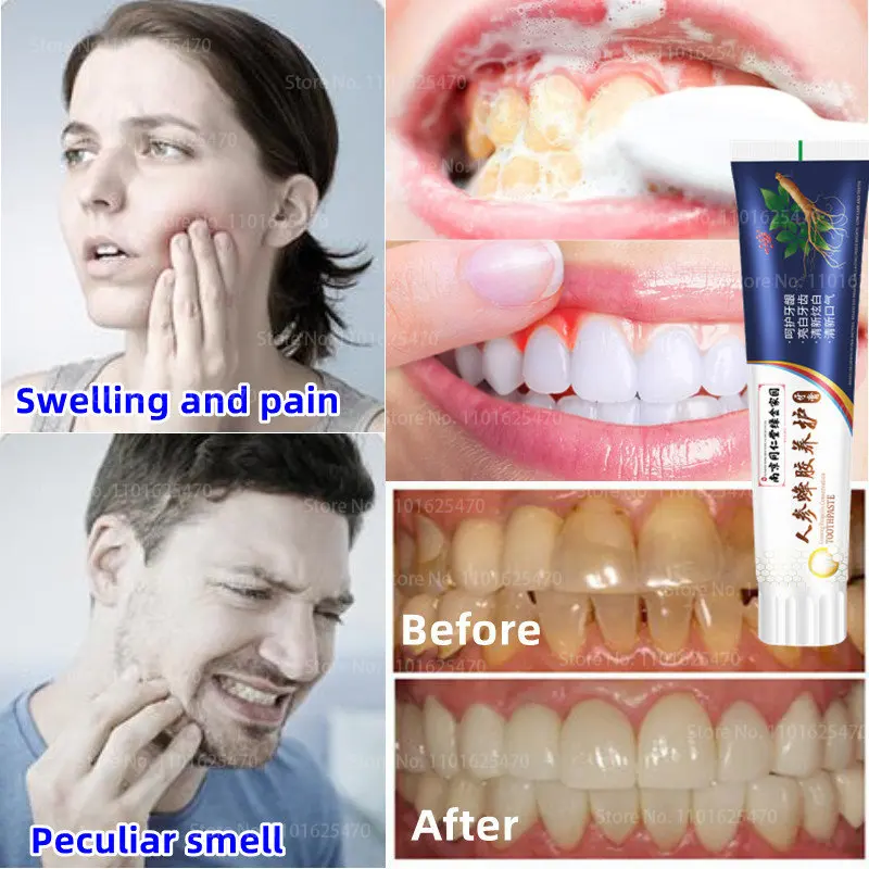 Ginseng Propolis Repair Toothpaste,Tooth Cleaning,Cavities,Caries,Filling,Removal Plaque,Stains,Decay,Yellowing Teeth Whitening
Ginseng Propolis Repair Toothpaste,Tooth Cleaning,Cavities,Caries,Filling,Removal Plaque,Stains,Decay,Yellowing Teeth Whitening