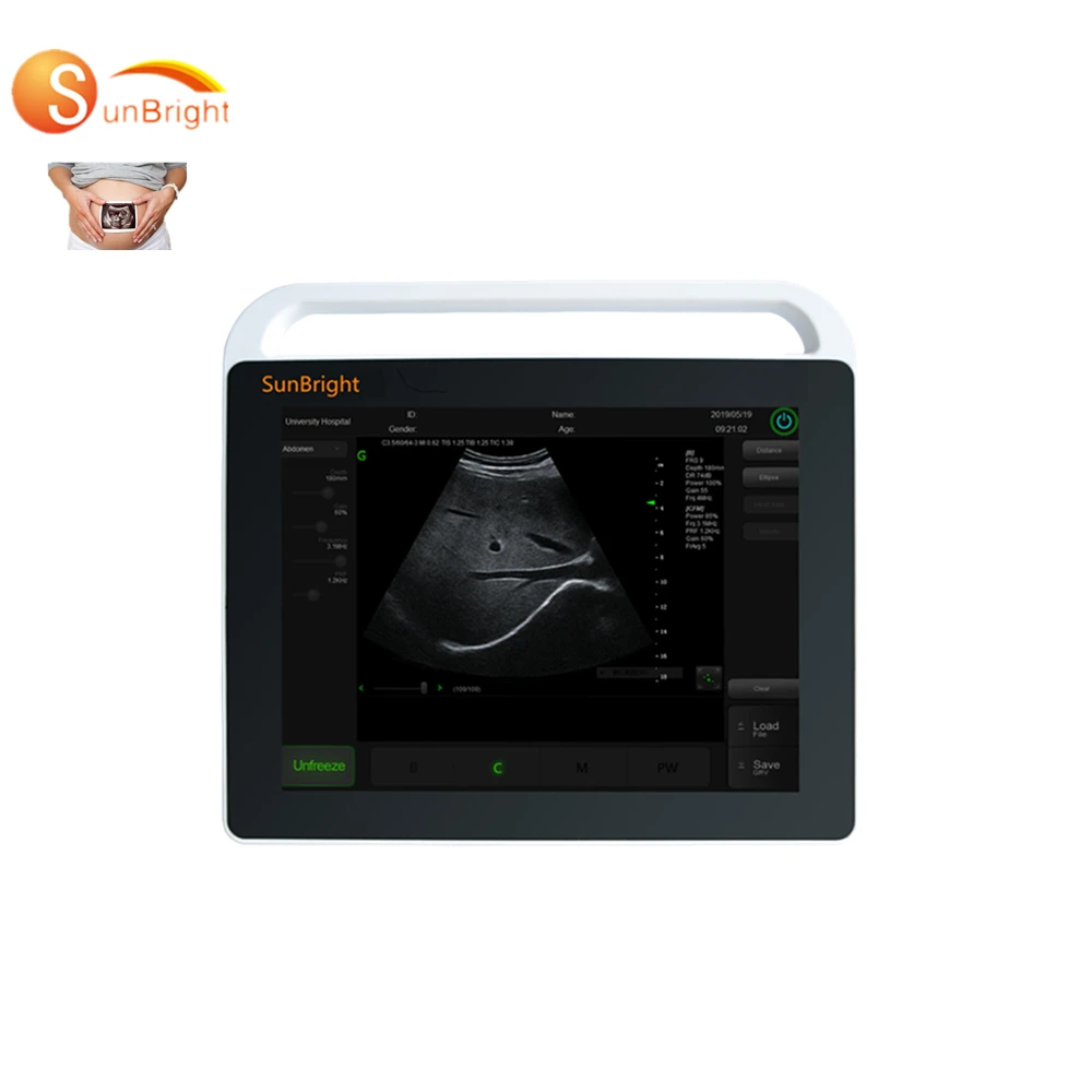 Планшет с 15-дюймовым сенсорным экраном Echo professional animal Test 2d Портативный Ветеринарный ультразвуковой сканирующий аппарат
Планшет с 15-дюймовым сенсорным экраном Echo professional animal Test 2d Портативный Ветеринарный ультразвуковой сканирующий аппарат