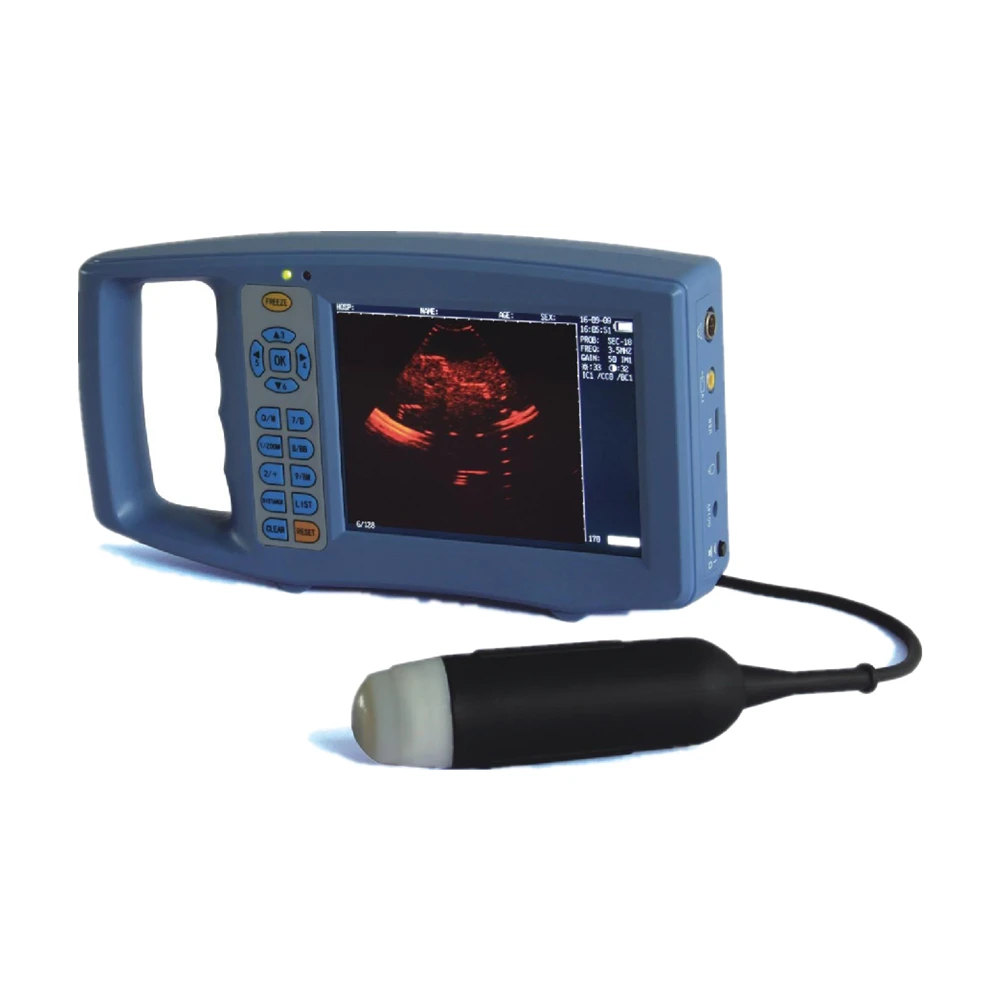 Mayamed 5.6 inch TFT LCD Dual Frequencies Ultrasonic Probe VET Ultrasound Veterinary Portable Ultrasound Scanner
Mayamed 5.6 inch TFT LCD Dual Frequencies Ultrasonic Probe VET Ultrasound Veterinary Portable Ultrasound Scanner