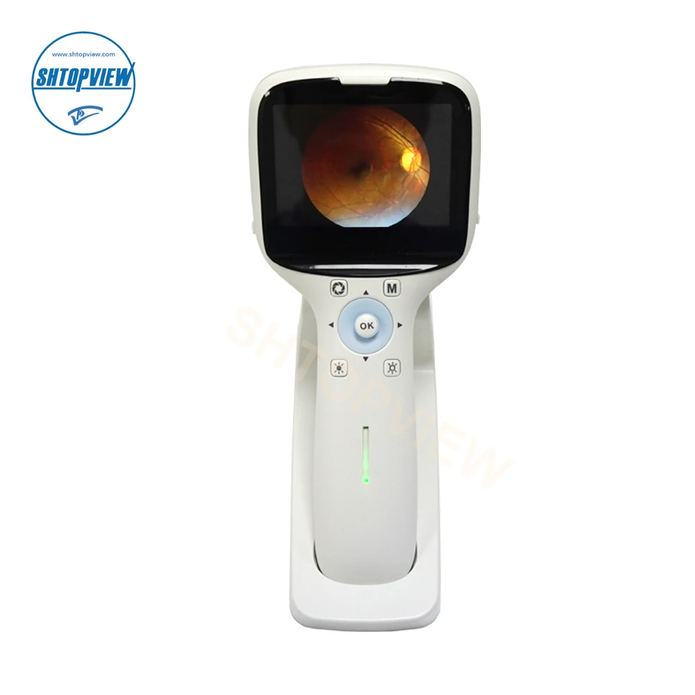 HD Ophthalmic Instrument Digital Portable Hand-held Fundus Camera Ophthalmic Equipment Handheld portable Fundus Camera HFC-1
HD Ophthalmic Instrument Digital Portable Hand-held Fundus Camera Ophthalmic Equipment Handheld portable Fundus Camera HFC-1