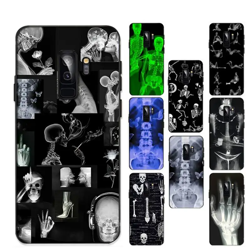 X-Ray Human Anatomy Phone Case for Samsung A51 A30s A52 A71 A12 for Huawei Honor 10i for OPPO vivo Y11 cover 
X-Ray Human Anatomy Phone Case for Samsung A51 A30s A52 A71 A12 for Huawei Honor 10i for OPPO vivo Y11 cover