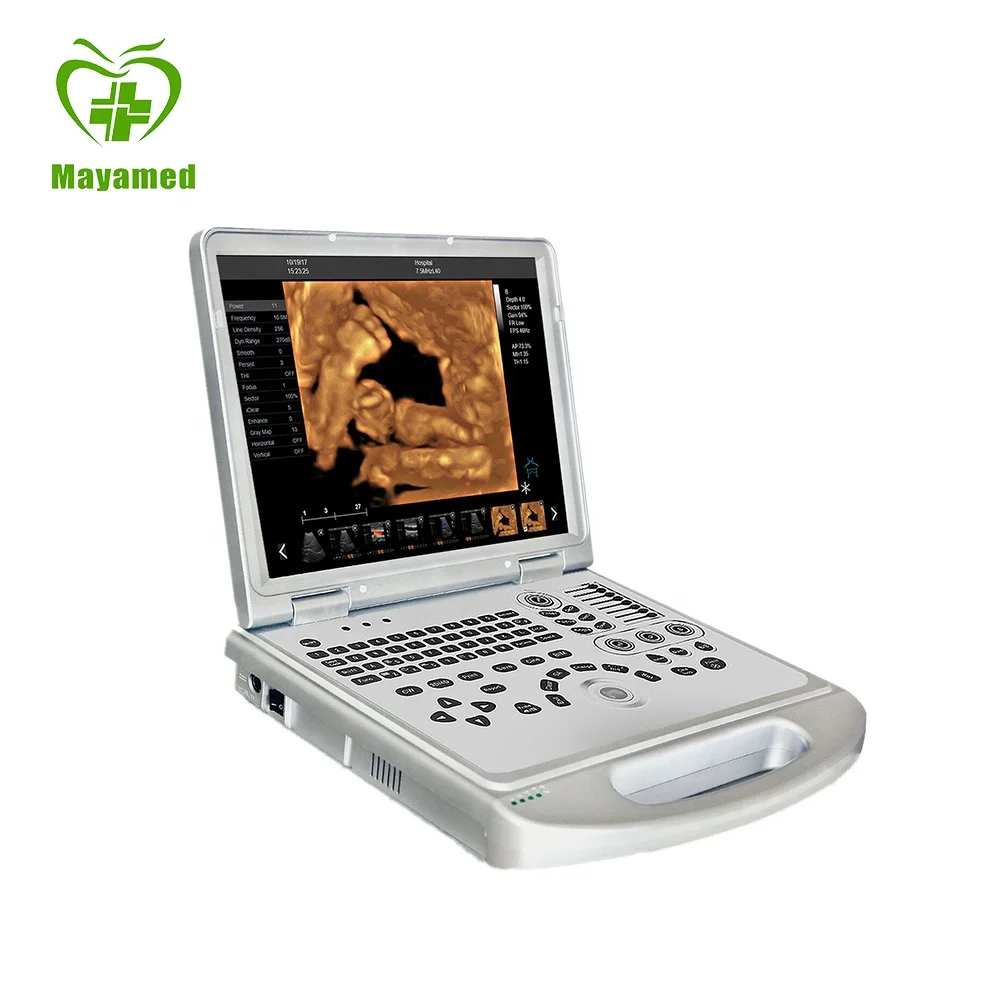 MY-A024B-N Portable advanced imaging technology Laptop CW Color Doppler Ultrasound Scanner
MY-A024B-N Portable advanced imaging technology Laptop CW Color Doppler Ultrasound Scanner