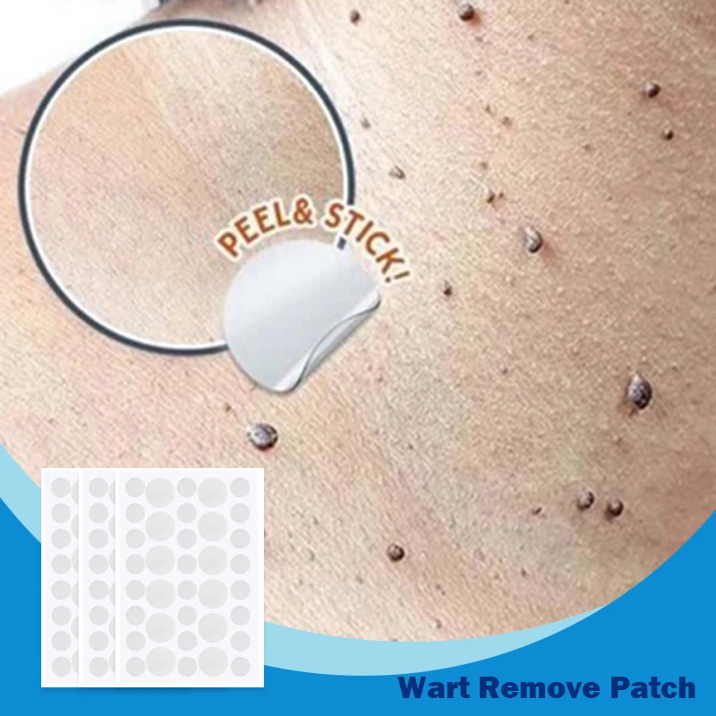 360/108/36pcs Skin Tag Remover Warts Remover Patch Wart Treatment Cream Herbal Extract Foot Corn Plaster Acne Warts Sticker
360/108/36pcs Skin Tag Remover Warts Remover Patch Wart Treatment Cream Herbal Extract Foot Corn Plaster Acne Warts Sticker
