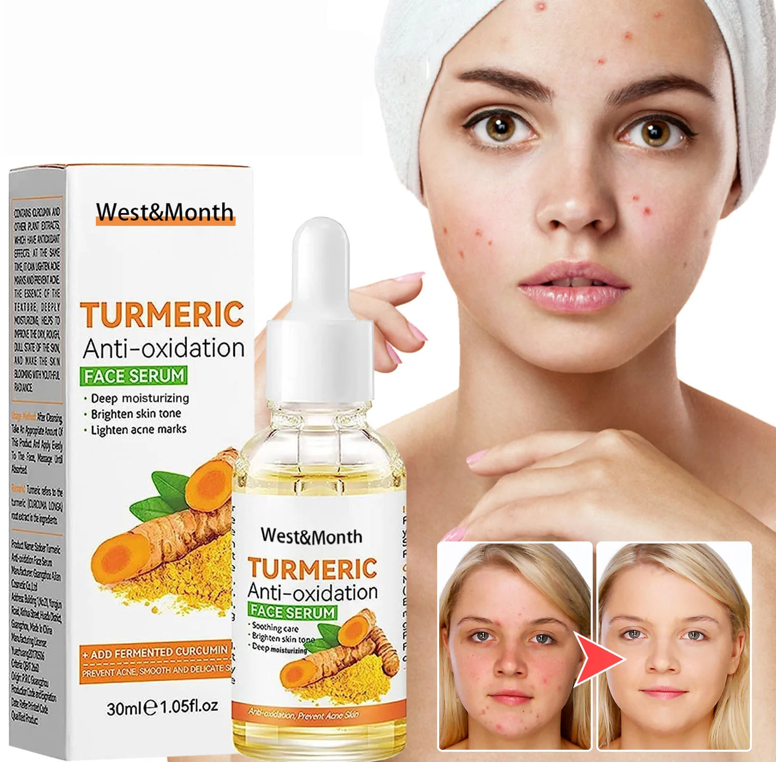 Turmeric Face Nourishing Essence Anti-aging Anti-acne Fade Dark Spots Blemishes Skin Moisturizing Repairing Face Brighten Serum
Turmeric Face Nourishing Essence Anti-aging Anti-acne Fade Dark Spots Blemishes Skin Moisturizing Repairing Face Brighten Serum